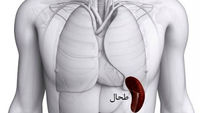 علت بزرگ شدن طحال چیست؟ / جدول و درمان + فیلم