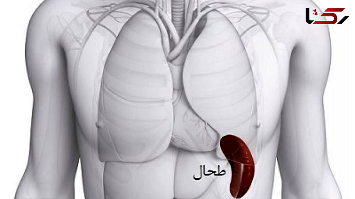 علت بزرگ شدن طحال چیست؟ / جدول و درمان 