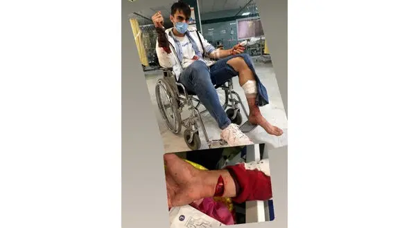 لحظه به لحظه با قمه خوردن فوتبالیست لیگ برتری توسط زورگیران + گفتگو و عکس