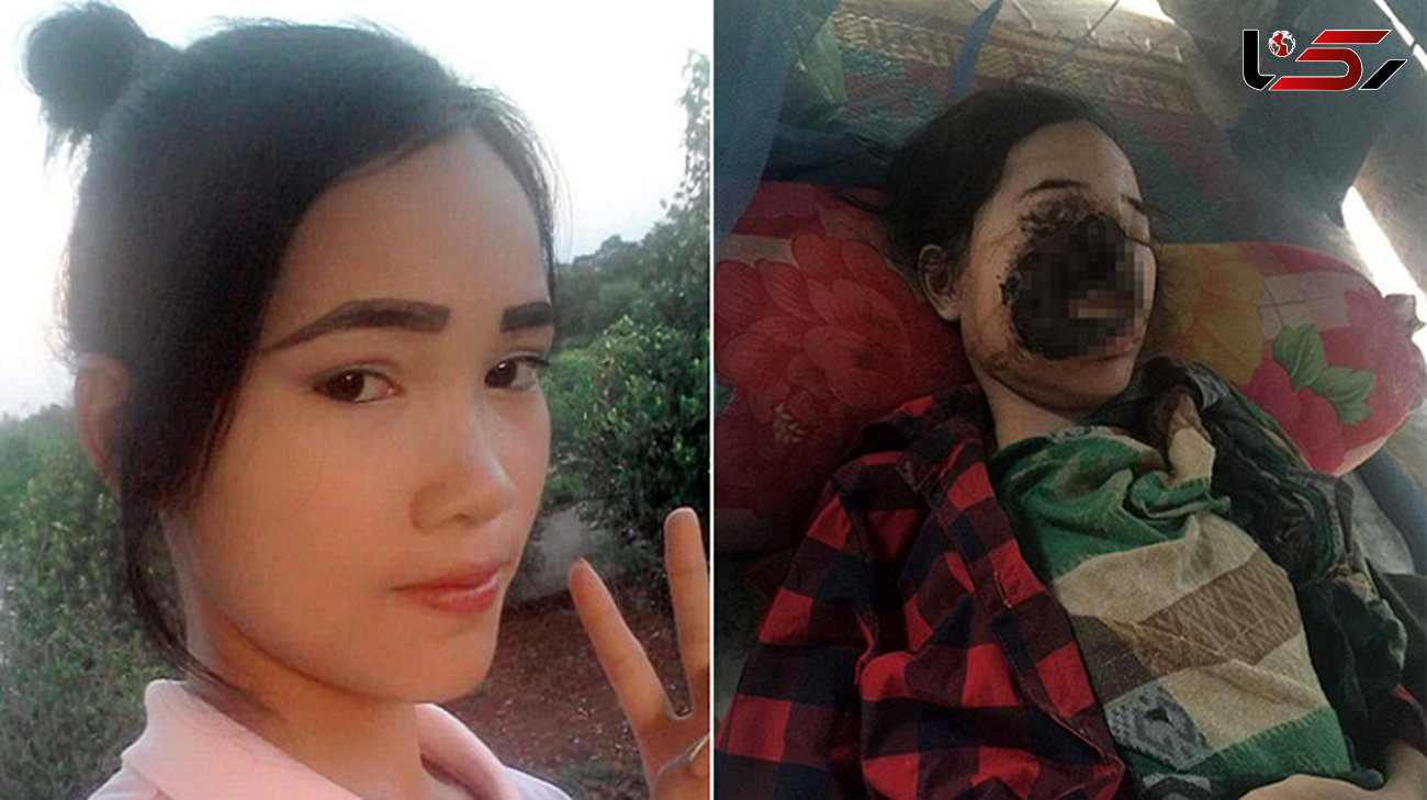 بسیار وحشتناک/بدن دختر جوان را خوردند!+عکس(16+)