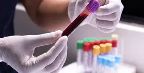 تفسیر نتایج آزمایش‌های پزشکی باید صرفا توسط پزشکان انجام شود، نه هوش مصنوعی