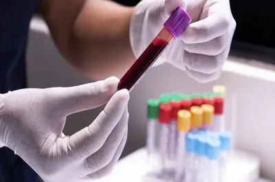 تفسیر نتایج آزمایش‌های پزشکی باید صرفا توسط پزشکان انجام شود، نه هوش مصنوعی