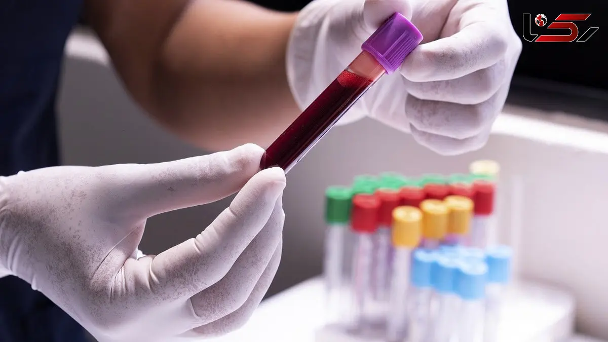 تفسیر نتایج آزمایش‌های پزشکی باید صرفا توسط پزشکان انجام شود، نه هوش مصنوعی