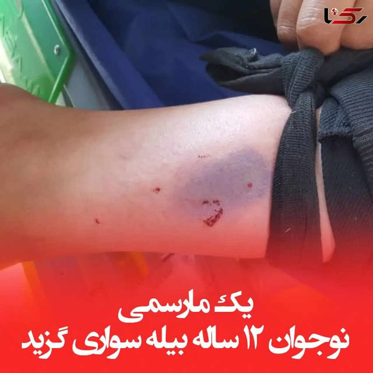 حمله نیش دار مارسمی به پسر 12 ساله ! / وحشت در خانه بیله سواری
