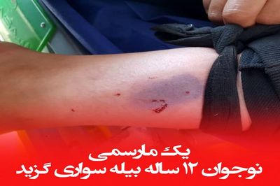 حمله نیش دار مارسمی به پسر 12 ساله ! / وحشت در خانه بیله سواری