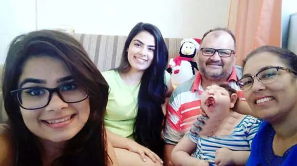 بیماری بسیار ترسناک این دختر بچه او را شبیه به هیولا کرد+ تصاویر دلخراش
