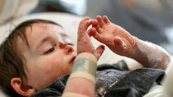 چرا وزارت بهداشت صدای بیماران "ای بی" را نمی شنود؟