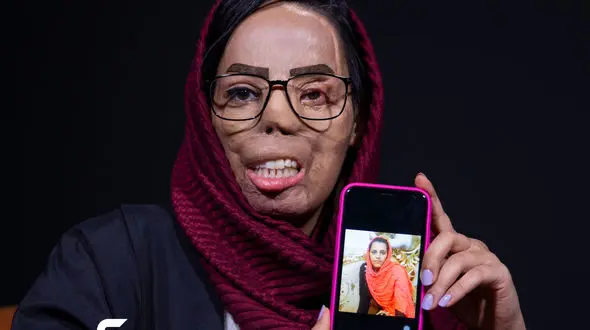 فریادهای تلخ نوعروس تهرانی / چهره ام را گرفت و حالا می خواهد آزاد شود + فیلم گفتگو و عکس