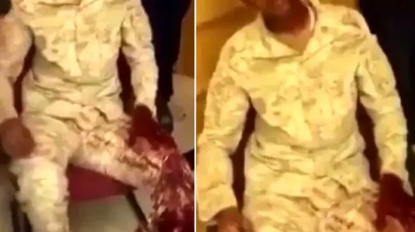 صحنه سازی دروغین سعودی ها از زخمی شدن یک سرباز وظیفه در یمن + فیلم