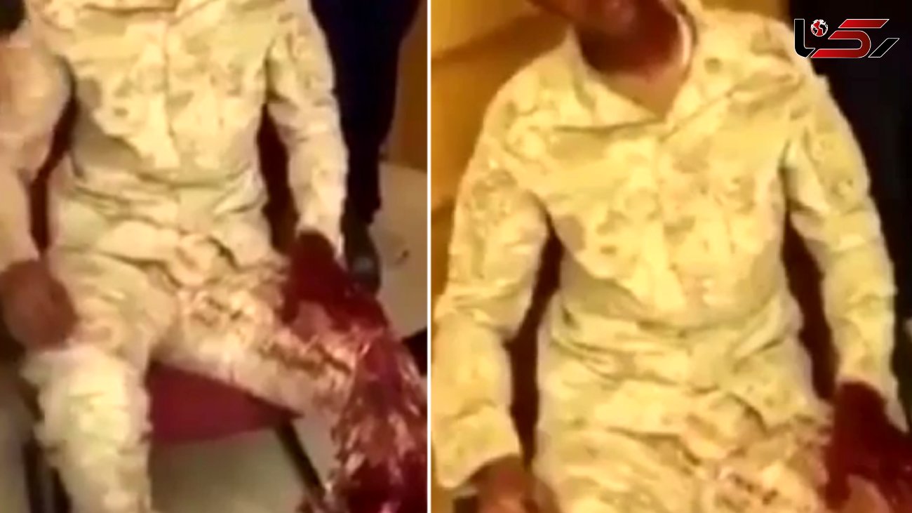 صحنه سازی دروغین سعودی ها از زخمی شدن یک سرباز وظیفه در یمن + فیلم