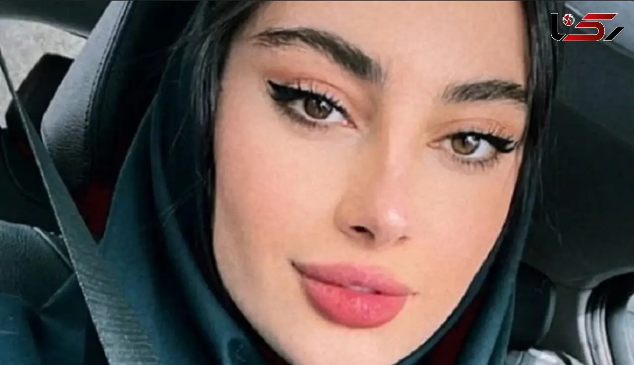 زشت ترین چهره ترلان پروانه ! / باورکردنی نیست با صورتش چه کرد ؟! + عکس