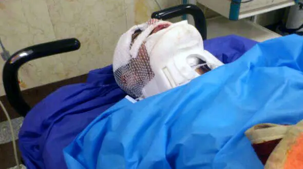 تصادف شدید آمبولانس اورژانس با یک کامیون در رباط کریم + عکس 