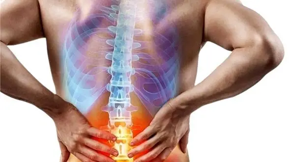 کمر درد و روش های پیشگیری از بیماری کمر درد