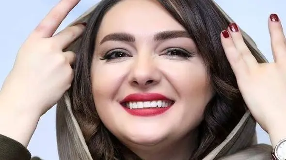 عکس شوک آور از چهره هانیه توسلی قبل از عمل زیبایی ! / کاش هیچ وقت پخش نمی شد !