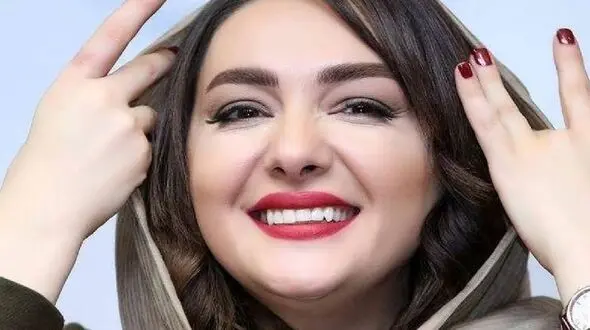 عکس شوک آور از چهره هانیه توسلی قبل از عمل زیبایی ! / کاش هیچ وقت پخش نمی شد !