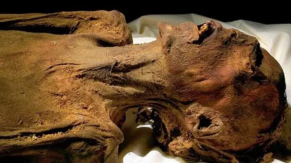 کاربرد دارویی مومیایی ها