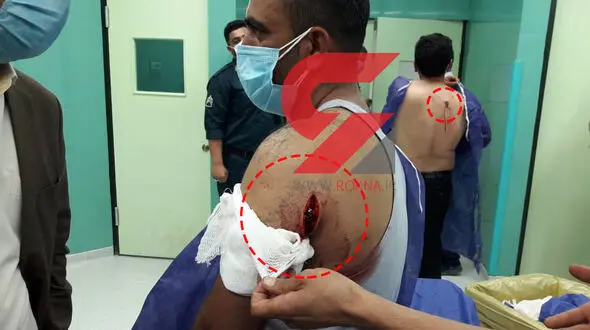 حمله وحشیانه 2 قاچاقچی چوب به جنگلبانان ساری + فیلم و عکس