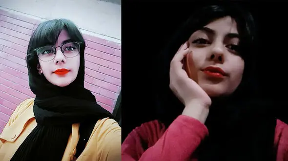 مرگ تلخ خانم مجری جوان بخاطر جوش صورت / صدای آیناز خاموش شد + عکس و فیلم