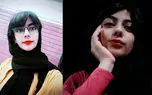 مرگ تلخ خانم مجری جوان بخاطر جوش صورت / صدای آیناز خاموش شد + عکس و فیلم