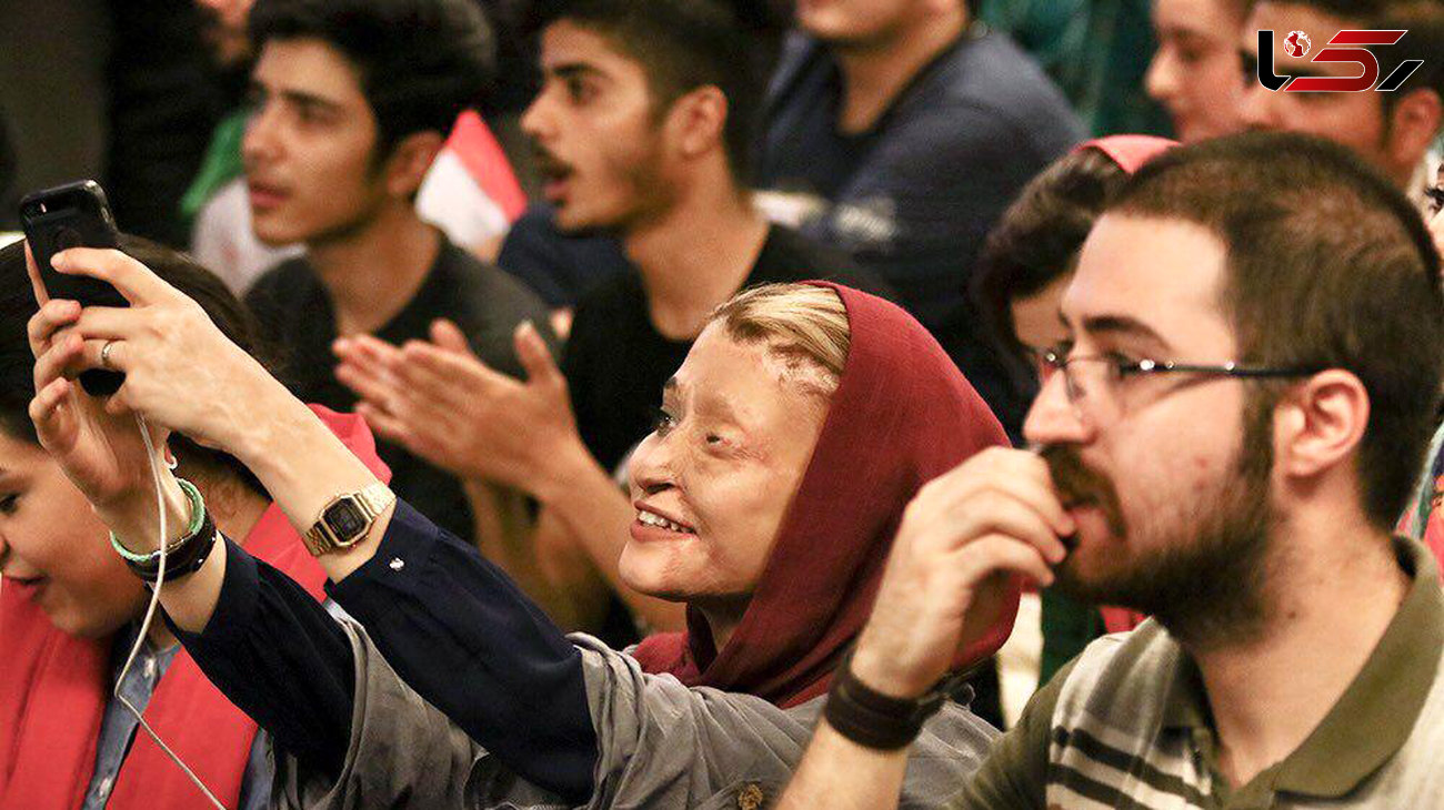 دختر اسیدسوخته اصفهان در حال تماشای فوتبال ایران و پرتغال + عکس