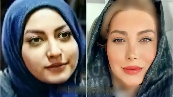 عکس قبل عمل زیبایی خانم بازیگران ایرانی + عکس ها و اسامی