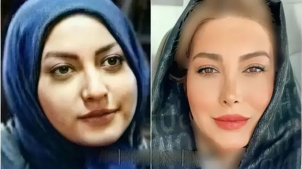 عکس قبل عمل زیبایی خانم بازیگران ایرانی + عکس ها و اسامی
