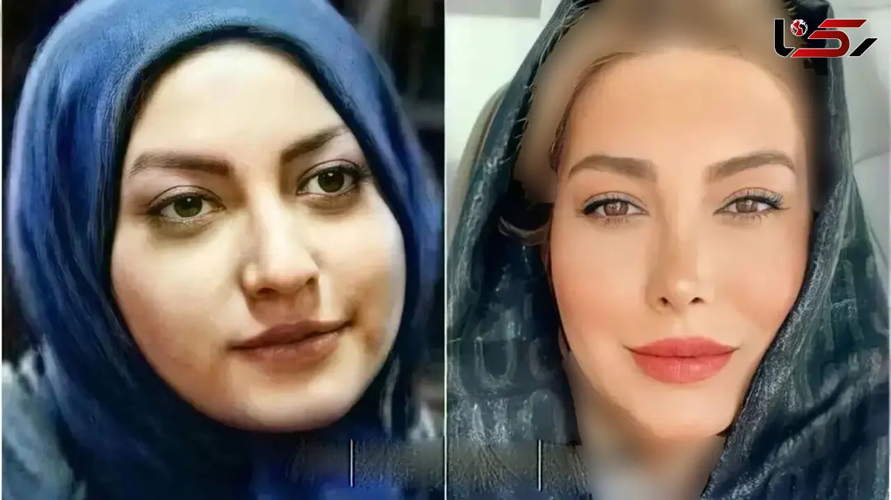 عکس قبل عمل زیبایی خانم بازیگران ایرانی + عکس ها و اسامی