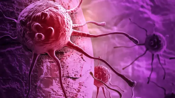 خطرناک ترین سرطان ها برای آقایان