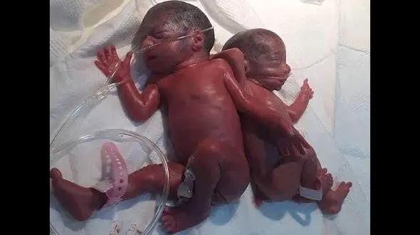 جزئیات تولد طبیعی 7 قلو در عراق + عکس