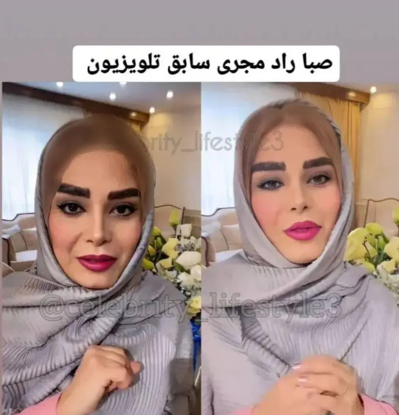 صباراد