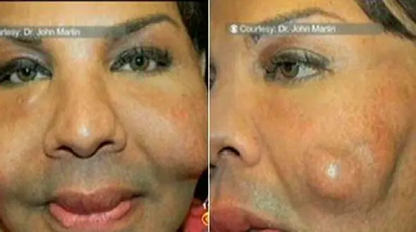 بلایی که دکتر زیبایی بر سر مرد در اتاق عمل آورد + عکس