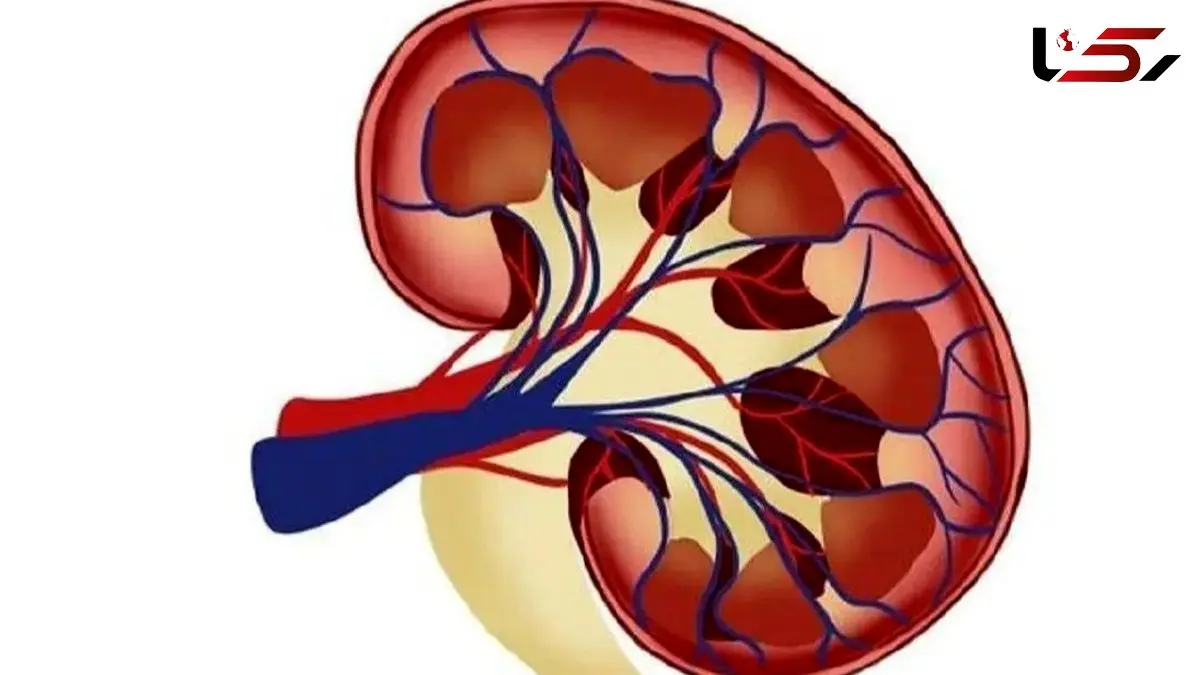 آیا ترکیب ایبوپروفن و کافئین به کلیه‌ ها آسیب می‌ زند؟ / پاسخ به پرسش های متداول