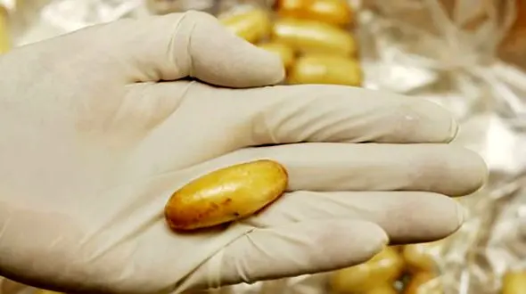 بلعیدن۱۰۶ کپسول کوکائین توسط زن خارجی +عکس
