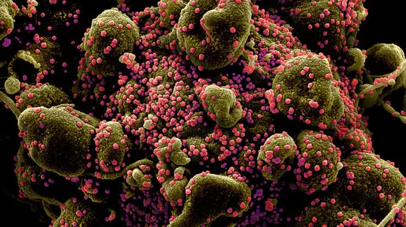 ماجرای بروز قارچ سیاه در کرونایی ها چیست؟/ دکتر مردانی پاسخ داد