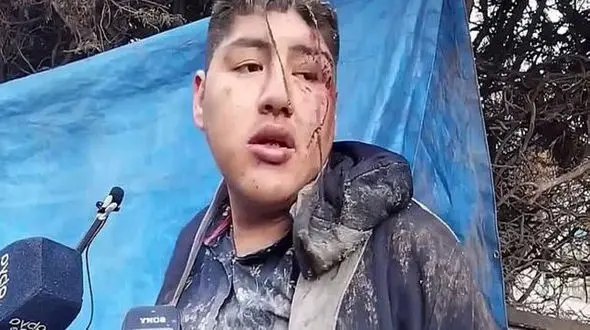 زنده به‌گور کردن مرد جوان در یک جشن محلی  + عکس