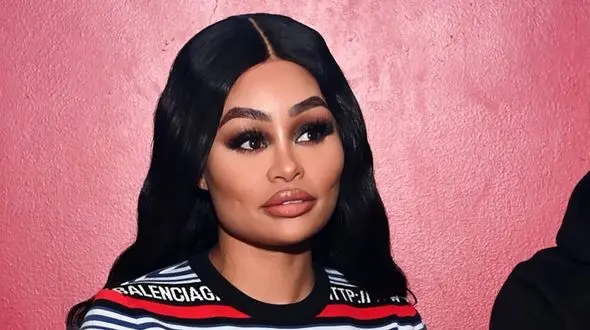 علت تصمیم غیرمنتظره بلک چاینا مدل معروف آمریکایی برای تخلیه ژل و فیلر لبش لو رفت+عکس