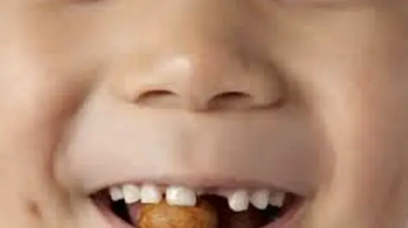 سن مناسب برای آجیل خوردن بچه ها