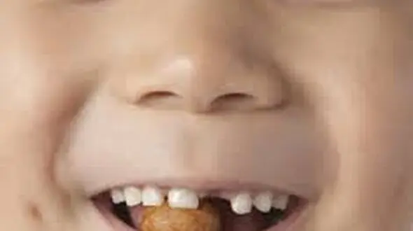 سن مناسب برای آجیل خوردن بچه ها