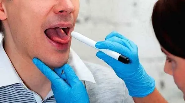 3 ترفند خانگی برای رفع سفیدی زبان