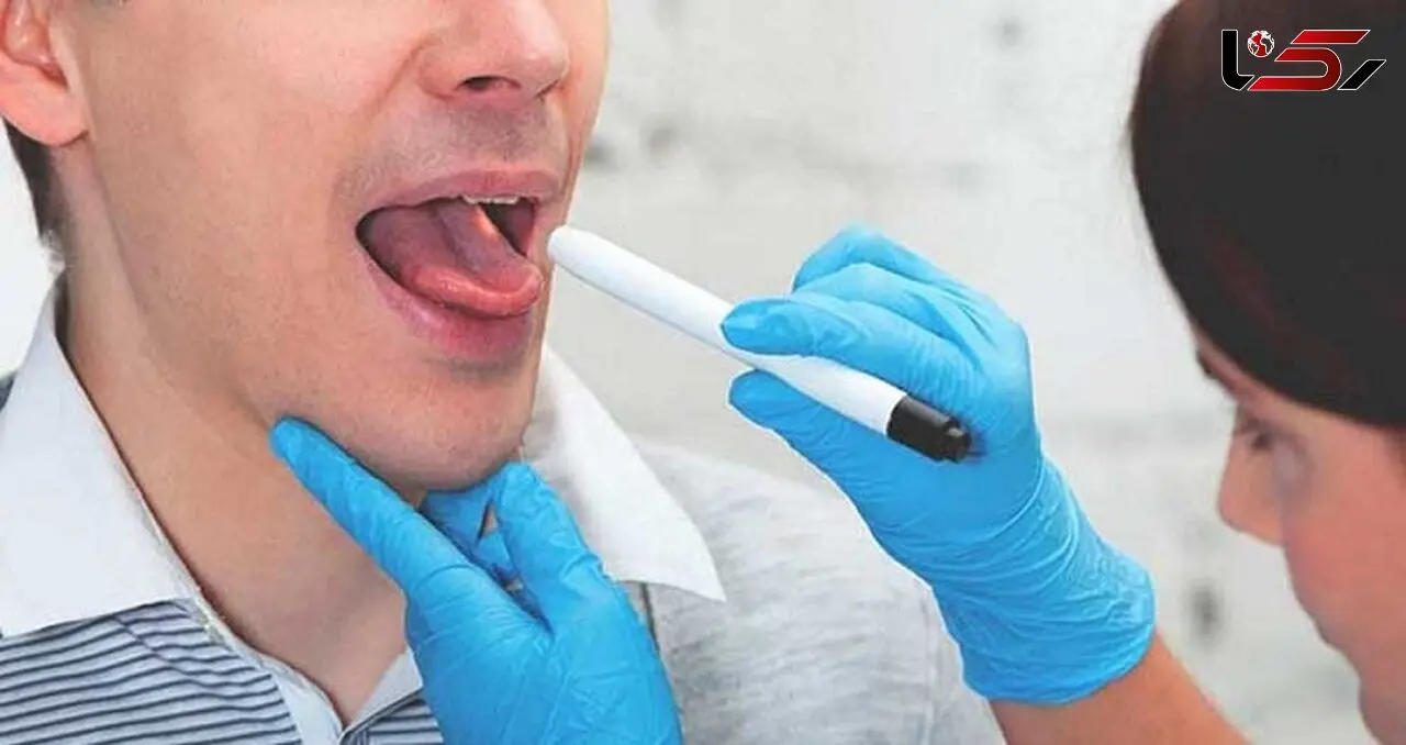 3 ترفند خانگی برای رفع سفیدی زبان
