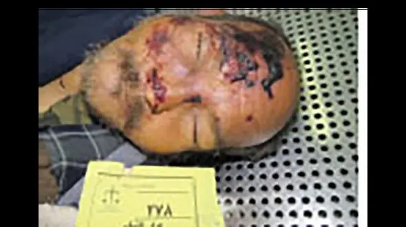 این جنازه متعلق به کیست ؟ / او را می شناسید ؟ + عکس جنازه