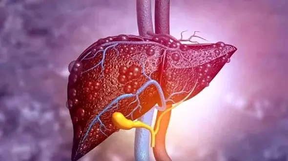 دشمنان کبدتان را بشناسید