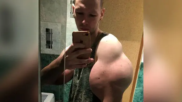 بیماری لاعلاج برای بندساز معروف+ تصویر