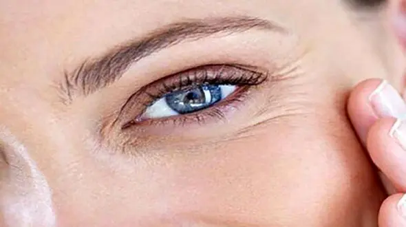 راهکارهای موثر و ارزان برای جلوگیری از چروک دور چشم