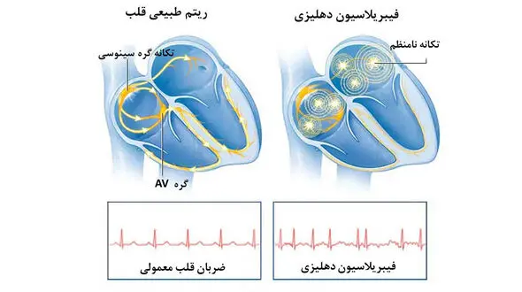 علائم هشدار دهنده برای ضربان قلب غیرعادی چیست؟