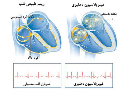 علائم هشدار دهنده برای ضربان قلب غیرعادی چیست؟