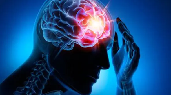 روزانه حدود ۵۰۰ نفر دچار سکته مغزی می‌شوند / سردرد شایع‌ترین علت مراجعه به درمانگاه‌ها