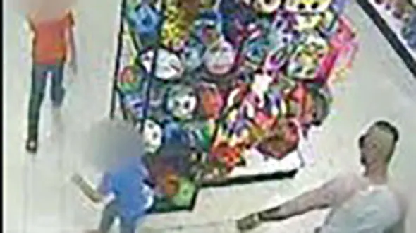 پدر روانی صورت فرزند 5 ساله خود را با اسید شست+ عکس