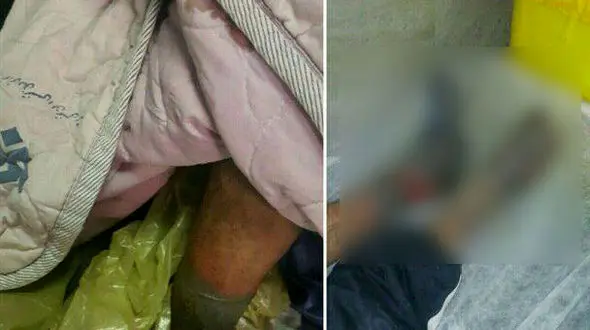 دستور وحشتناک دکتر به قطع پاهای یخ زده مرد کارتن خواب+عکس