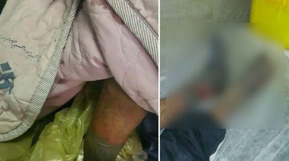 دستور وحشتناک دکتر به قطع پاهای یخ زده مرد کارتن خواب+عکس